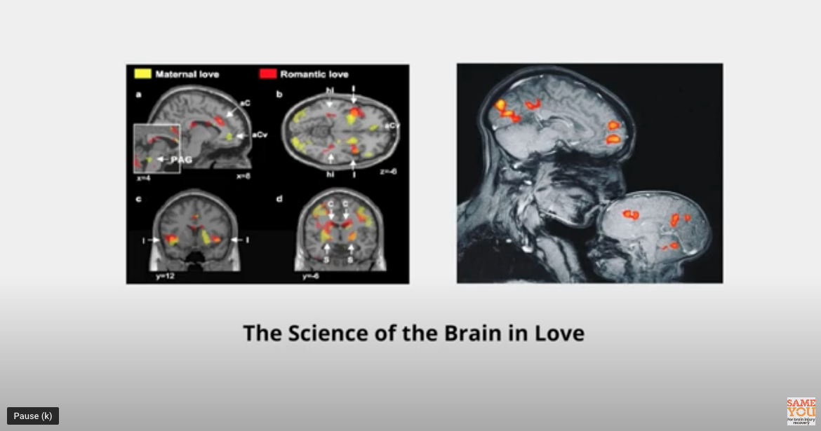 Positive Minds: Rehabilitating Love Post Brain Injury - Part Two image